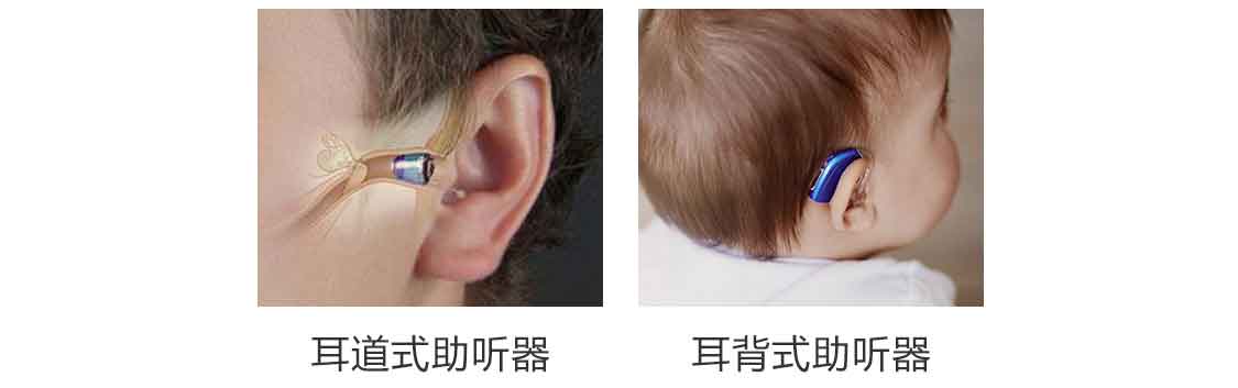 怎么給老年人買助聽器（圖3）